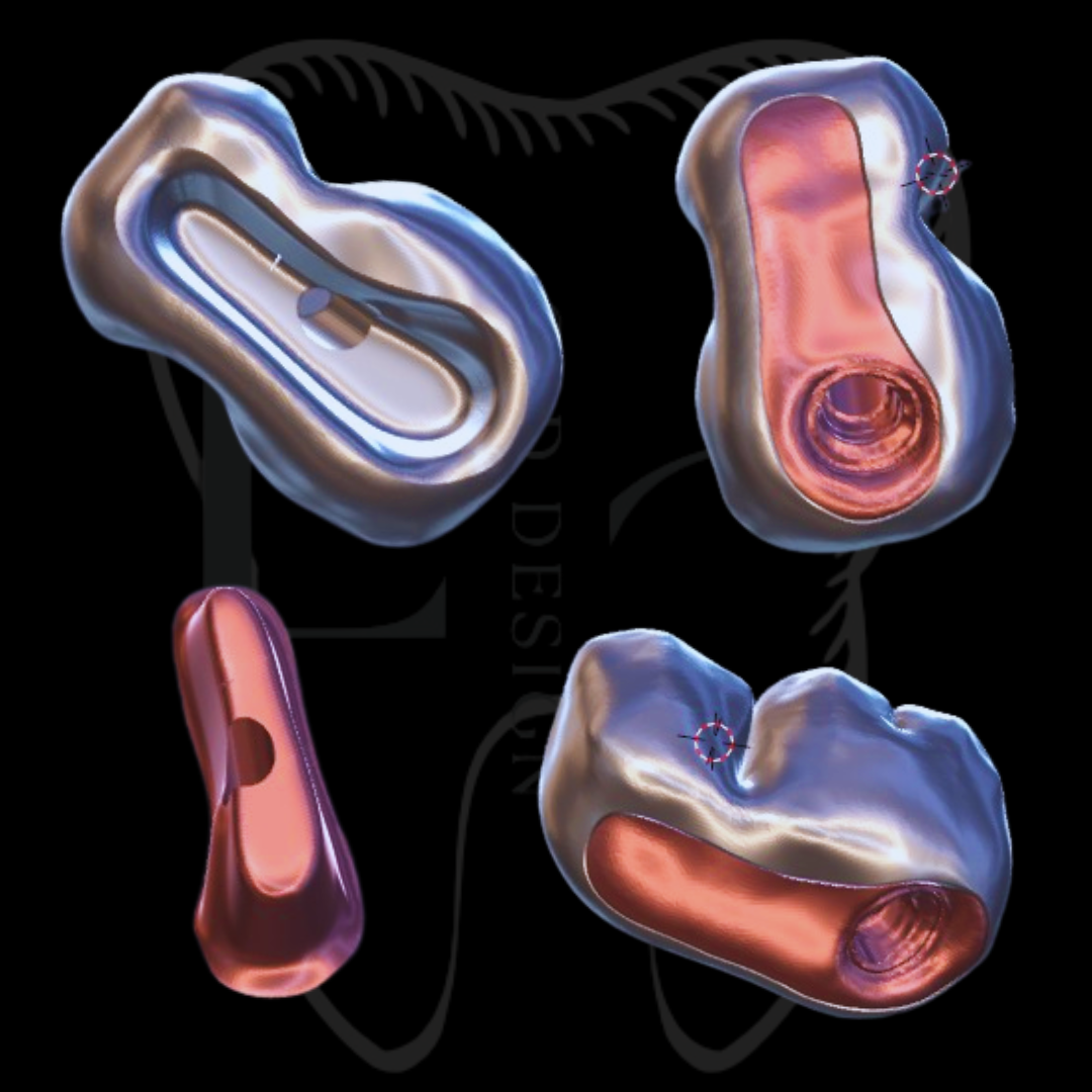 Protocolo I-bar no Exocad